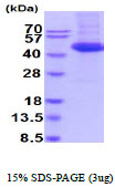 3ug by SDS-PAGE under reducing condition and visualized by coomassie blue stain.