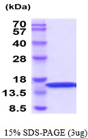 3ug by SDS-PAGE under reducing condition and visualized by coomassie blue stain.