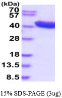 3ug by SDS-PAGE under reducing condition and visualized by coomassie blue stain.