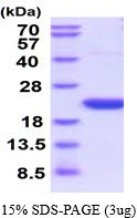 3ug by SDS-PAGE under reducing condition and visualized by coomassie blue stain.