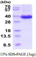 3ug by SDS-PAGE under reducing condition and visualized by coomassie blue stain.