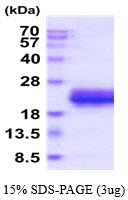 3ug by SDS-PAGE under reducing condition and visualized by coomassie blue stain.