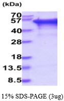 3ug by SDS-PAGE under reducing condition and visualized by coomassie blue stain.