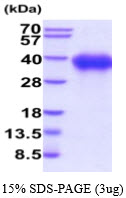 3ug by SDS-PAGE under reducing condition and visualized by coomassie blue stain.