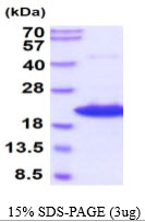 3ug by SDS-PAGE under reducing condition and visualized by coomassie blue stain.