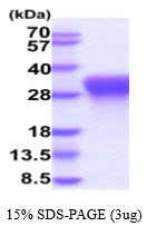 3ug by SDS-PAGE under reducing condition and visualized by coomassie blue stain.