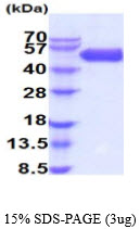 3ug by SDS-PAGE under reducing condition and visualized by coomassie blue stain.