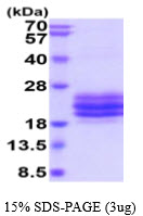 3ug by SDS-PAGE under reducing condition and visualized by coomassie blue stain.