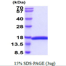 3ug by SDS-PAGE under reducing condition and visualized by coomassie blue stain.