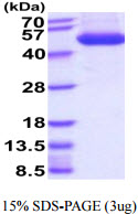 3ug by SDS-PAGE under reducing condition and visualized by coomassie blue stain.