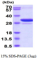 3ug by SDS-PAGE under reducing condition and visualized by coomassie blue stain.