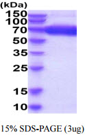 3ug by SDS-PAGE under reducing condition and visualized by coomassie blue stain.