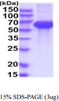 3ug by SDS-PAGE under reducing condition and visualized by coomassie blue stain.