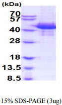 3ug by SDS-PAGE under reducing condition and visualized by coomassie blue stain.