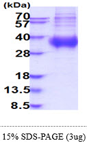 3ug by SDS-PAGE under reducing condition and visualized by coomassie blue stain.