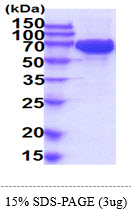 3ug by SDS-PAGE under reducing condition and visualized by coomassie blue stain.