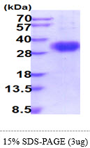 3ug by SDS-PAGE under reducing condition and visualized by coomassie blue stain.