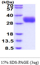 3ug by SDS-PAGE under reducing condition and visualized by coomassie blue stain.