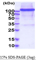 3ug by SDS-PAGE under reducing condition and visualized by coomassie blue stain.