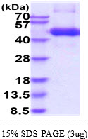 3ug by SDS-PAGE under reducing condition and visualized by coomassie blue stain.