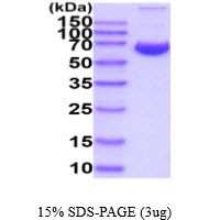 3ug by SDS-PAGE under reducing condition and visualized by coomassie blue stain.