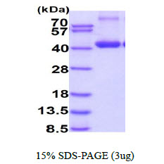 3ug by SDS-PAGE under reducing condition and visualized by coomassie blue stain.