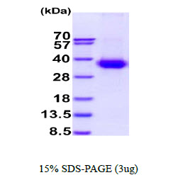 3ug by SDS-PAGE under reducing condition and visualized by coomassie blue stain.