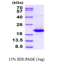 3ug by SDS-PAGE under reducing condition and visualized by coomassie blue stain.