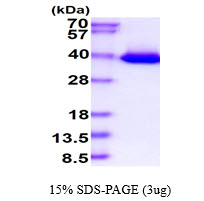 3ug by SDS-PAGE under reducing condition and visualized by coomassie blue stain.