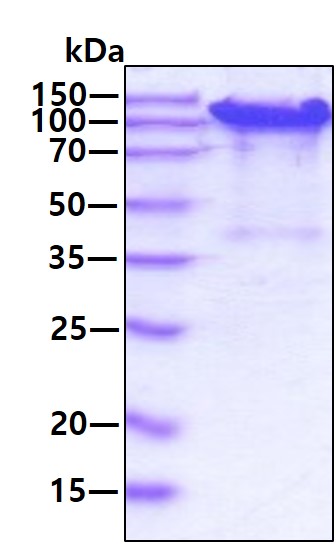 3ug by SDS-PAGE under reducing condition and visualized by coomassie blue stain.