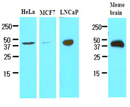 Cell lysates of HeLa, MCF7, LNCaP and mouse brain (30ug) were resolved by SDS-PAGE, transferred to NC membrane and probed with anti-human TREM2 (1:500). Proteins were visualized using a goat anti-mouse secondary antibody conjugated to HRP and an ECL detection system.