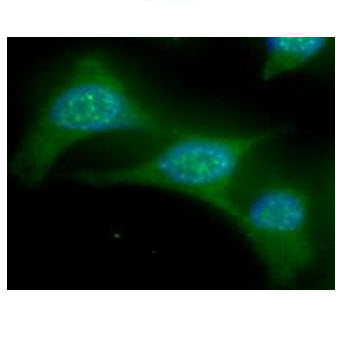 ICC/IF analysis of UBE2L6 in HeLa cells line, stained with DAPI (Blue) for nucleus staining and monoclonal anti-human UBE2L6 antibody (1:100) with goat anti-mouse IgG-Alexa fluor 488 conjugate (Green).