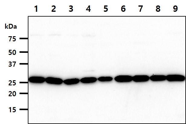 Cell lysates of HeLa (30ug) were resolved by SDS-PAGE, transferred to PVDF membrane and probed with anti-human UNG (1:1000). Proteins were visualized using a goat anti-mouse secondary antibody conjugated to HRP and an ECL detection system.
