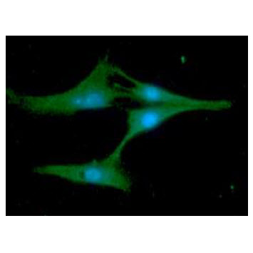 ICC/IF analysis of Synaptobrevin2 in U87MG cells line, stained with DAPI (Blue) for nucleus staining and monoclonal anti-human Synaptobrevin2 antibody (1:100) with goat anti-mouse IgG-Alexa fluor 488 conjugate (Green).