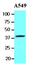 The lysates of A549 (20ug) were resolved by SDS-PAGE, transferred to NC membrane and probed with anti-human Wnt3a (1:1000). Proteins were visualized using a goat anti-mouse secondary antibody conjugated to HRP and an ECL detection system.