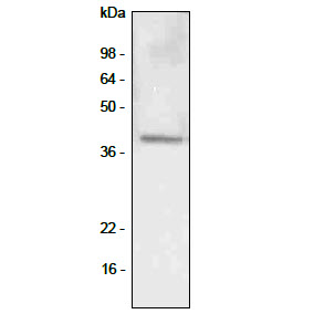 ZXL-MESET-(1) （ZXL-ME-(1)）主装置 基本架 NTT αZX （未使用