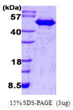 3ug by SDS-PAGE under reducing condition and visualized by coomassie blue stain.