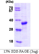 3ug by SDS-PAGE under reducing condition and visualized by coomassie blue stain.