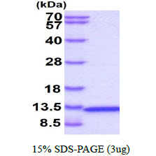 3ug by SDS-PAGE under reducing condition and visualized by coomassie blue stain.