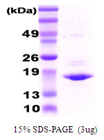 3ug by SDS-PAGE under reducing condition and visualized by coomassie blue stain.