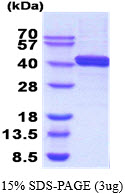 3ug by SDS-PAGE under reducing condition and visualized by coomassie blue stain.