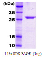 3ug by SDS-PAGE under reducing condition and visualized by coomassie blue stain.