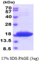 3ug by SDS-PAGE under reducing condition and visualized by coomassie blue stain.