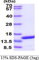 3ug by SDS-PAGE under reducing condition and visualized by coomassie blue stain.