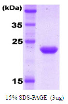 3ug by SDS-PAGE under reducing condition and visualized by coomassie blue stain.