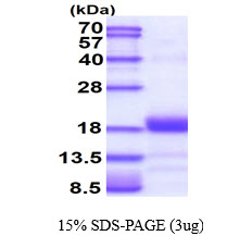 3ug by SDS-PAGE under reducing condition and visualized by coomassie blue stain.