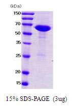 3ug by SDS-PAGE under reducing condition and visualized by coomassie blue stain.