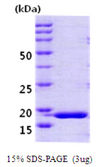 3ug by SDS-PAGE under reducing condition and visualized by coomassie blue stain.