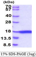 3ug by SDS-PAGE under reducing condition and visualized by coomassie blue stain.