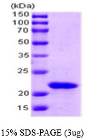 3ug by SDS-PAGE under reducing condition and visualized by coomassie blue stain.